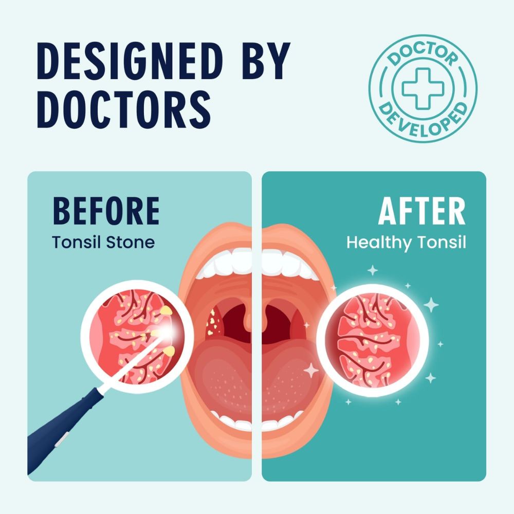 Dr. Frederick's Tonsil Stone Remover Kit