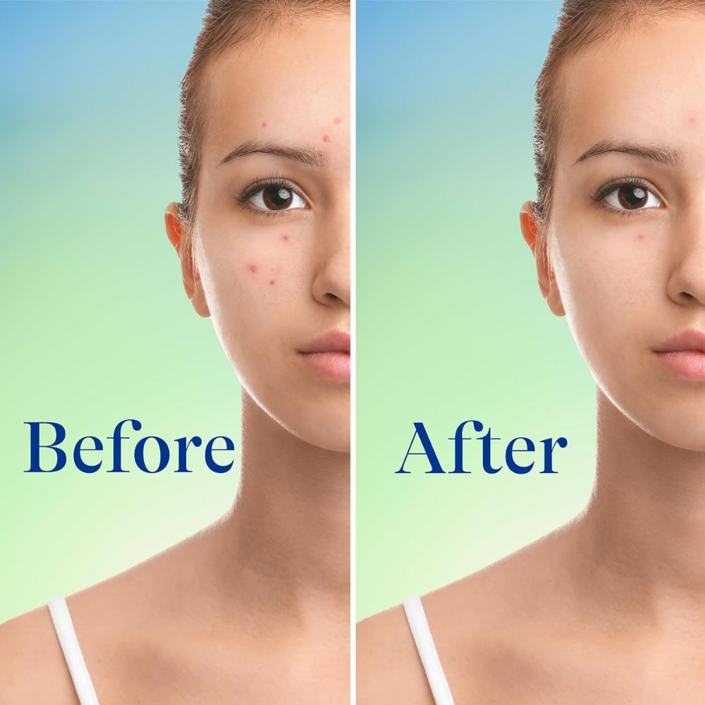 Differin Acne Face Wash